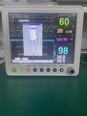 12.1 polegadas dispositivos de primeiros socorros sinais vitais monitor monitor doente