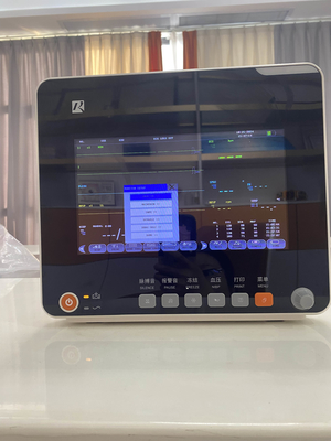 Monitor de doentes com múltiplos parâmetros com ECG Resp SpO2 Nibp Temp e suporte móvel OEM disponível