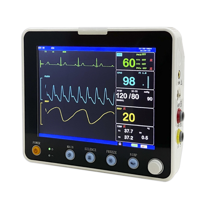 ECG ICU Multi-Parametro do paciente Monitor portátil Equipamento hospitalar Opcional ETCO2 versão animal