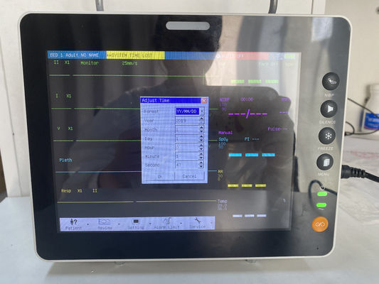 Monitor de Paciente Multiparamétrico Portátil com 1 Ano de Garantia, 2 Anos de Validade e ECG de 7 Canais para Uso em UTI