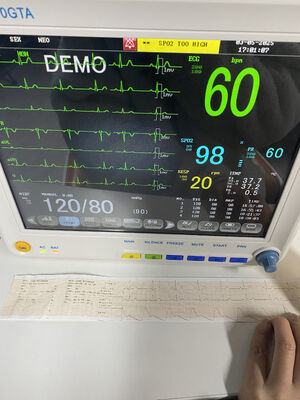 Monitor portátil de cabeceira com ECG SPO2 NIBP TEMP RESP Opcional ETCO2-Classe II Garantia de 1 ano